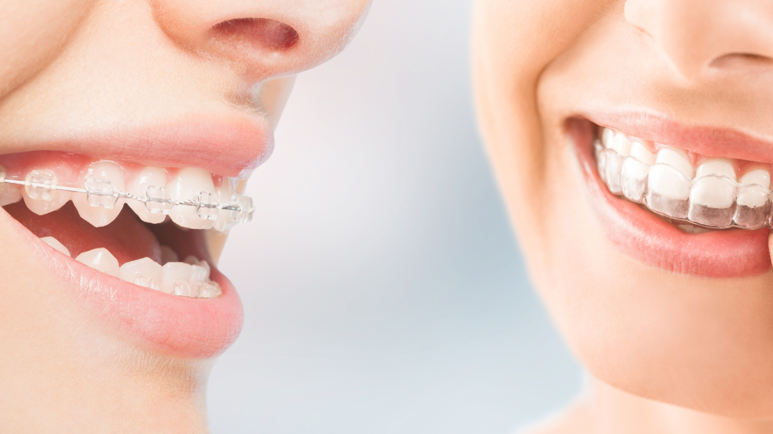 Blog Size Template (1110 